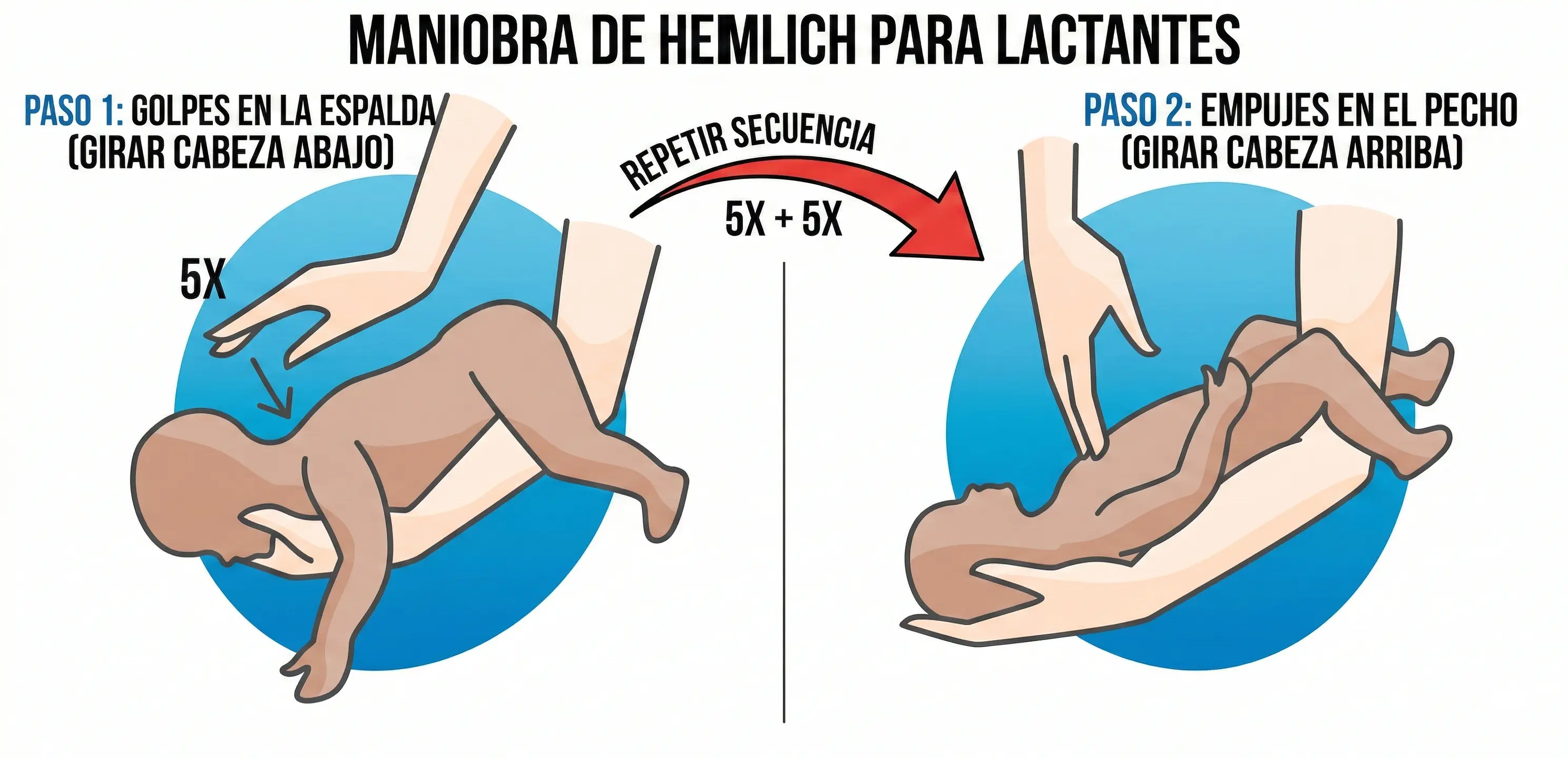 Maniobra de Heimlich en lactantes