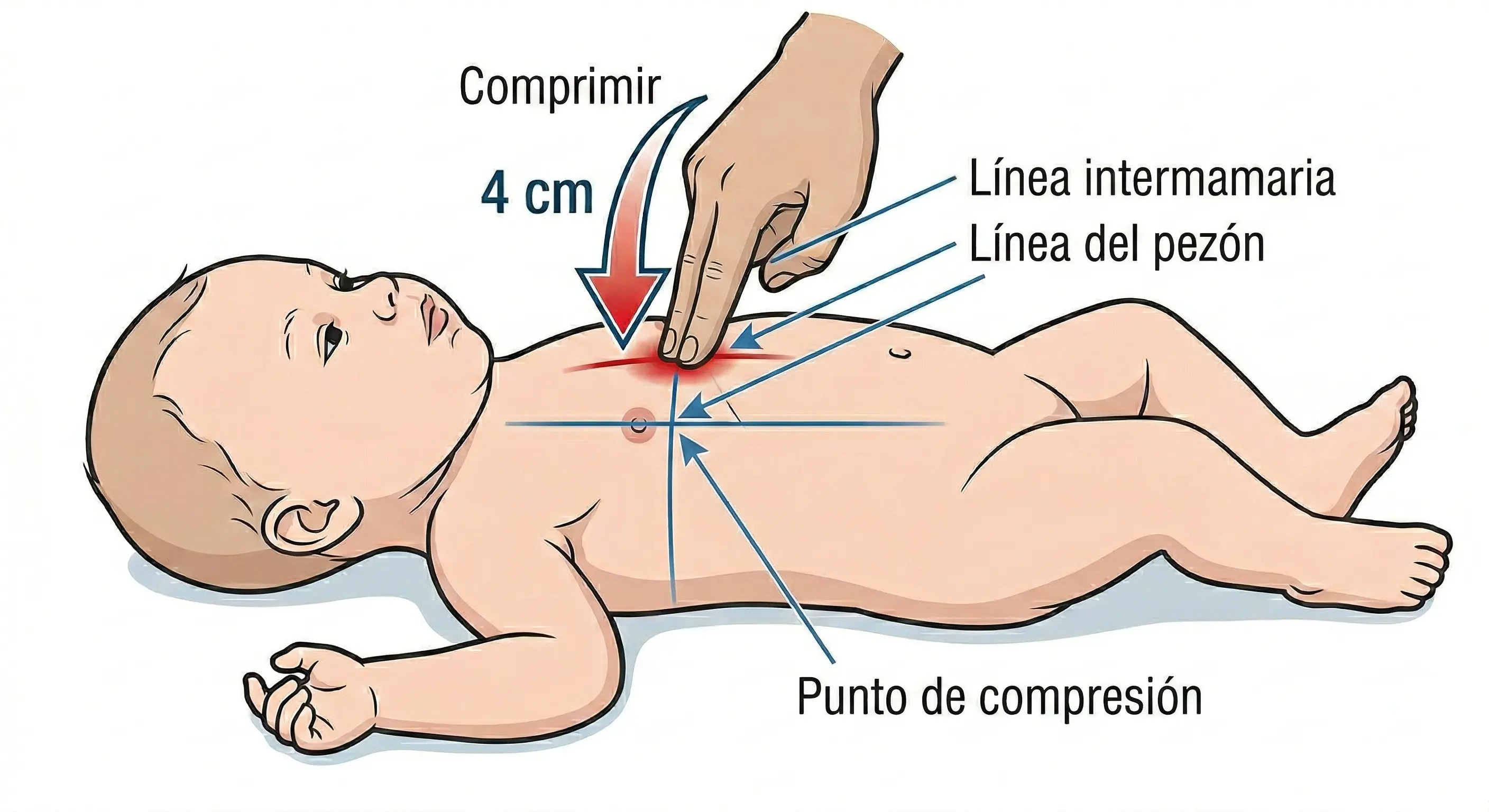 Técnica de RCP neonatal con dos dedos